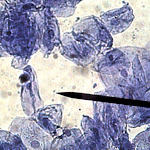 cell_cheek_06_400x.jpg