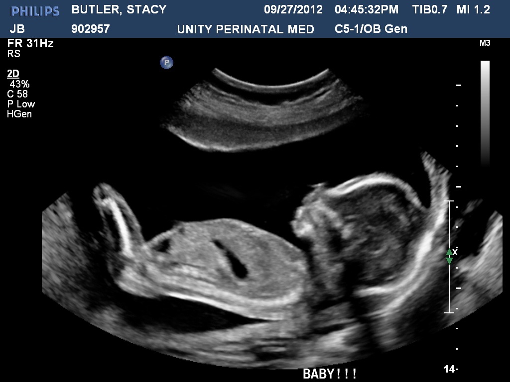 [BUTLERSTACY20120927164532743%255B1%255D.jpg]