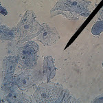 cheek04.jpg