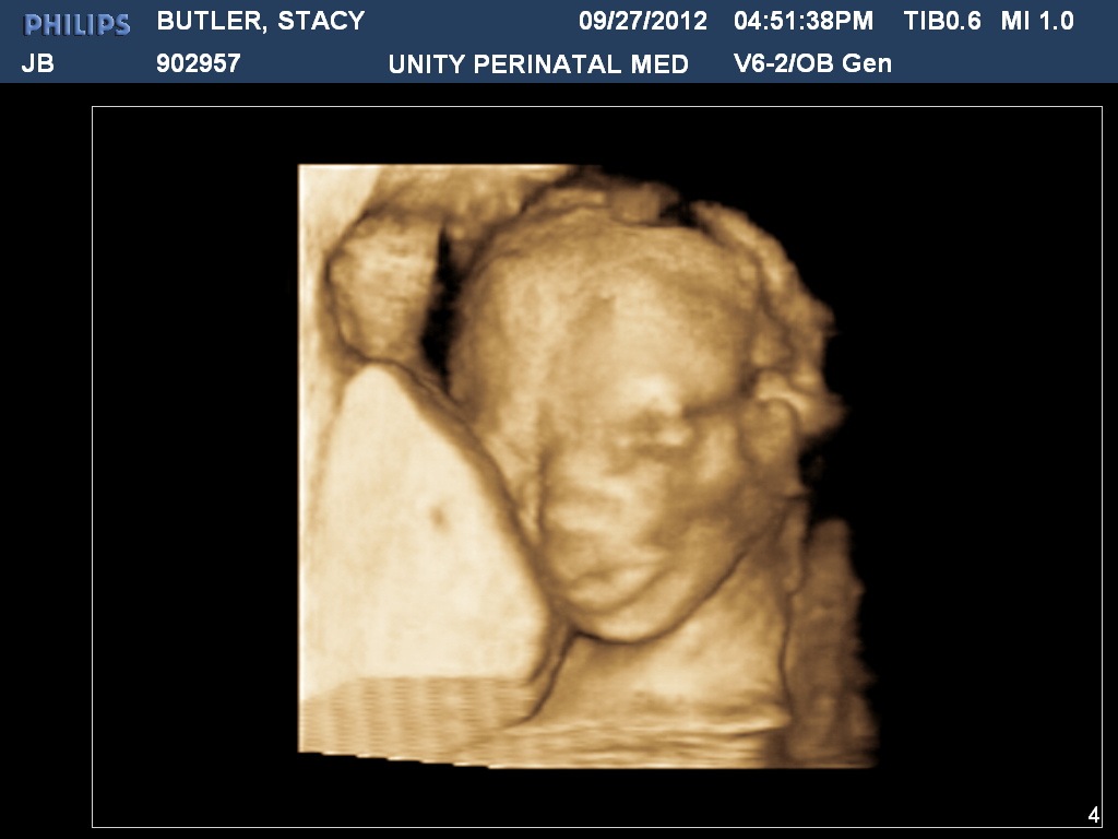 [BUTLERSTACY20120927165138079%255B1%255D.jpg]