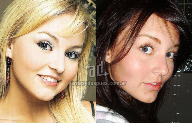 La nueva nariz operada de Angelique Boyer