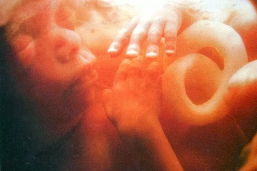 foetus_5_months.jpg Foetus 5 months