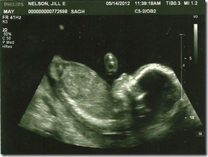 19 wks 2