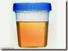urine sample