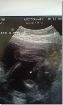 Baby M Gender Ultrasound