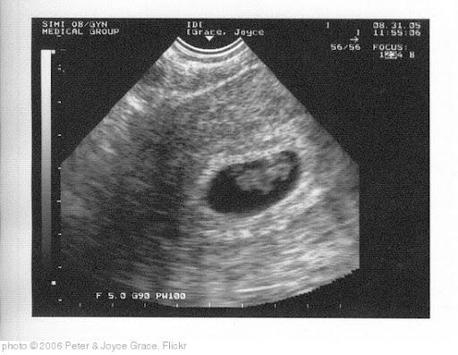 'baby' photo (c) 2006, Peter & Joyce Grace - license: http://creativecommons.org/licenses/by/2.0/