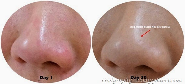 Cellnique Skin Action Sebum Gel review nose Cellnique Skin Action Sebum Gel review nose