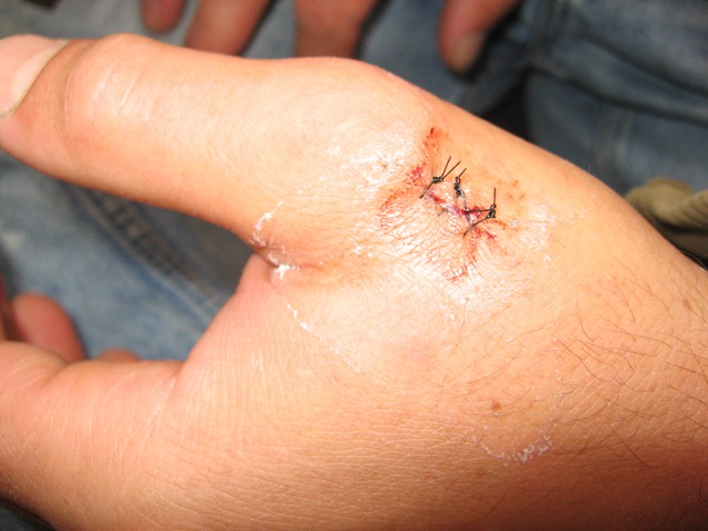 [injury%2520002%255B3%255D.jpg]