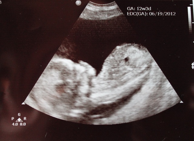 [BabyC%2520009%255B4%255D.jpg]