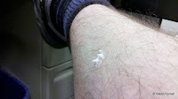 Damn you, mosquitoes!