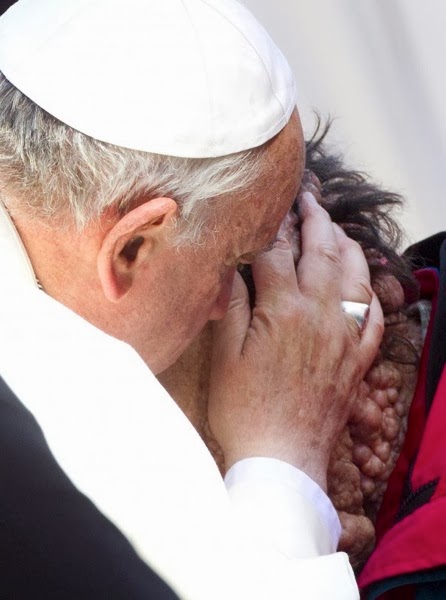 pope_disfigured_man.jpg Pope disfigured man