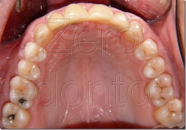 P1010874 (1)