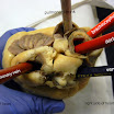 heart_pulmonary_vein_labeled.JPG