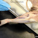 tibialis_anterior_L.JPG
