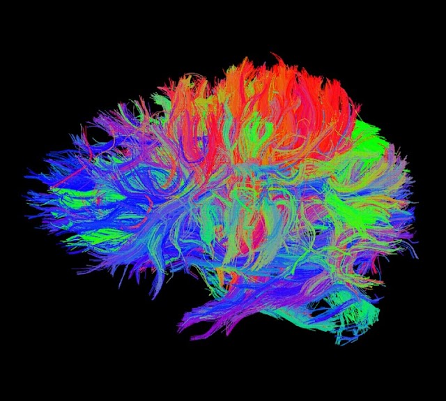 brains.jpg
