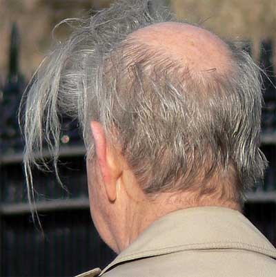[comb_overs_34%255B2%255D.jpg]