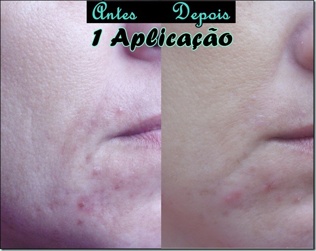 Fluid O2 e Serum Pérola Vergel- Os melhores cremes para manchas com efeito lifting! Fluid O2 e Serum Pérola Vergel- Os melhores cremes para manchas com efeito lifting!