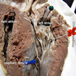 heart_pinned_closer_labeled.JPG