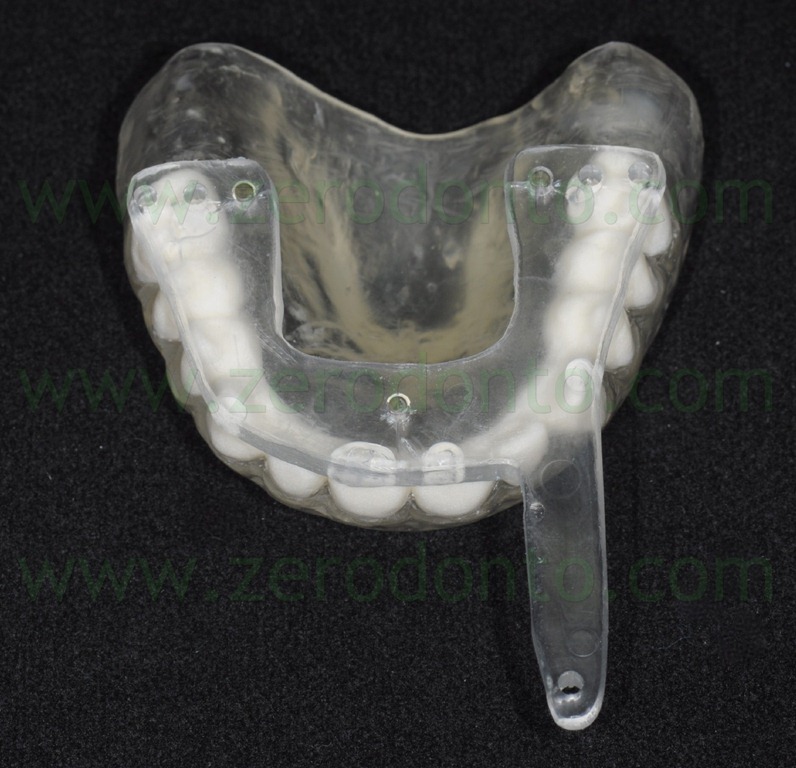 [--58-mascherina-radiologica1.jpg]