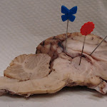 brain_dissect06.jpg brain_dissect06.jpg