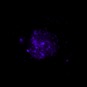M101 em raios X