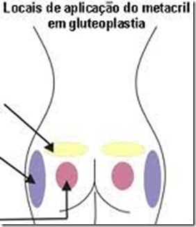PAAAAA4anNlu7yqqDnpnTcrILtZ4c_j_vtB0UjJvTuN8GsJppOqejcgSVIT8FtPEoRaSfBn50OyAsrWrzdP6xsoqhmEAm1T1UJOseH8cqBhGpd-Q4lRMXzt0Tzs1 - Cópia PAAAAA4anNlu7yqqDnpnTcrILtZ4c_j_vtB0UjJvTuN8GsJppOqejcgSVIT8FtPEoRaSfBn50OyAsrWrzdP6xsoqhmEAm1T1UJOseH8cqBhGpd-Q4lRMXzt0Tzs1 - Cópia
