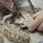brain_dissect08.jpg brain_dissect08.jpg