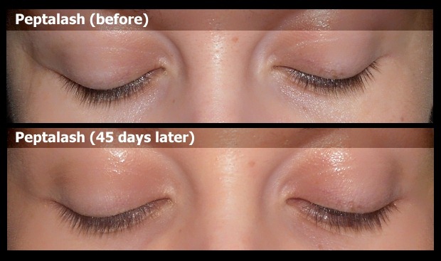 [01-peptalash-before-after-result-photo%255B4%255D.jpg]