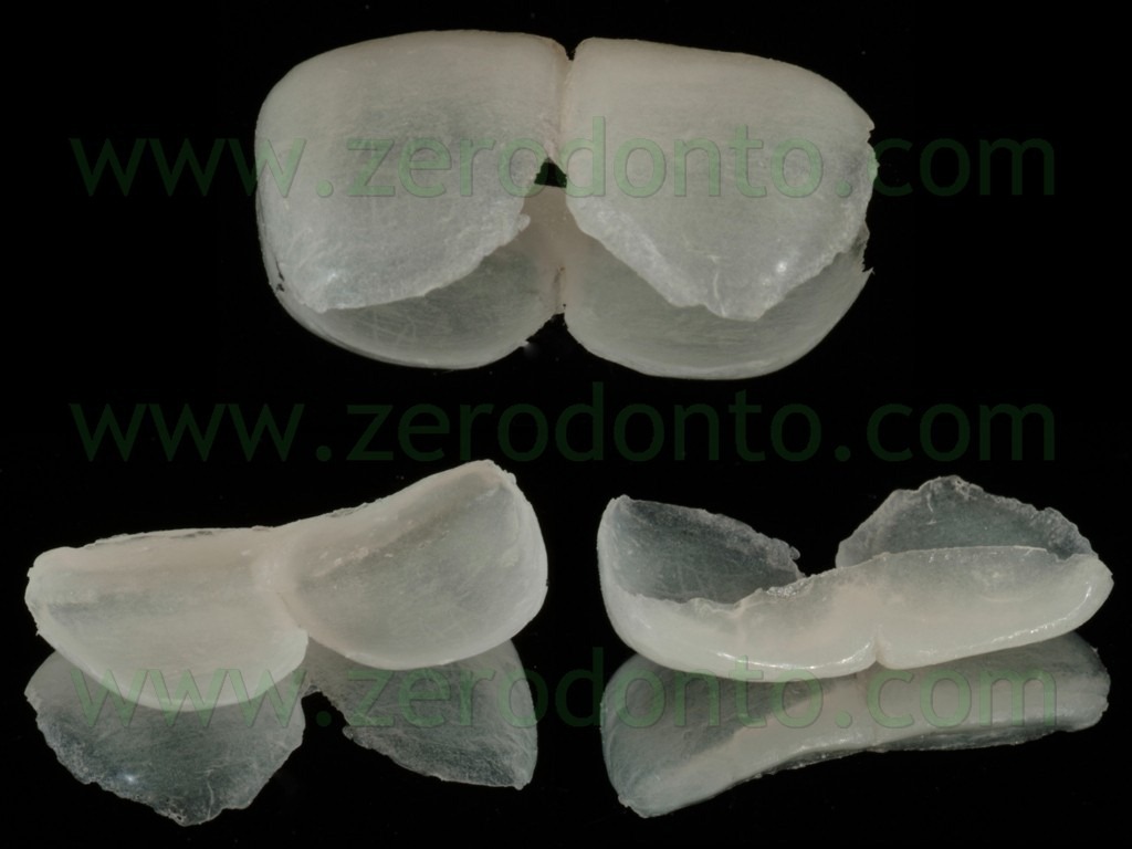 [20-mockup-veneer3.jpg]