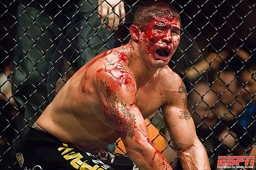[UFC_BLOOD-MMA-VIOLENCE3.jpg]