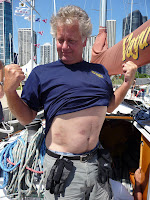 Verve Cup 2010 / Verve 2010: Sunday after racing.  Paul Holtzman (Vayu) shows off hiking bruises.
