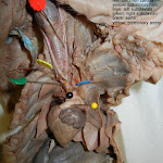 fetal_pig_heart_vessels_labeled.jpg