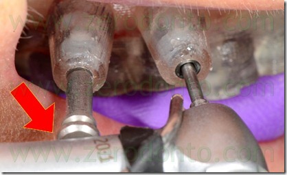 blog.065 blog.065