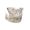 teeth_child_UofT.jpg