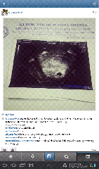 Instagram Izreen