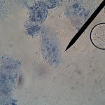 cheek07.jpg