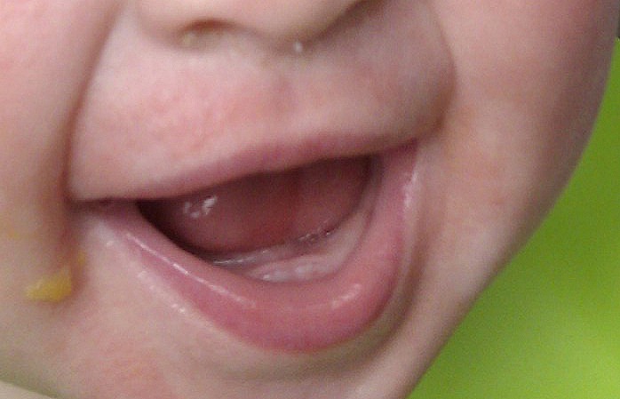 [teeth_zoom%255B5%255D.jpg]