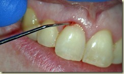Preop photo exploration015