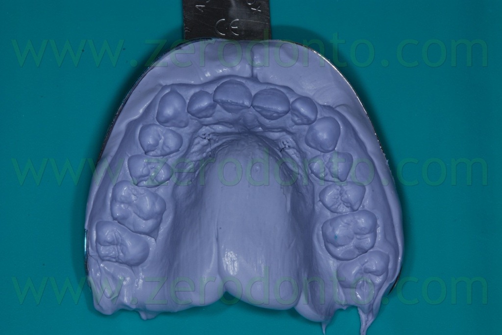 [11%2520impronta%2520dentale%255B2%255D.jpg]
