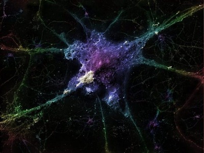 Neurônio - Por Linnea Rundgren