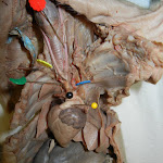 fetal_pig_heart_vessels.JPG
