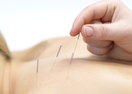 [acupuntura%255B2%255D.jpg]