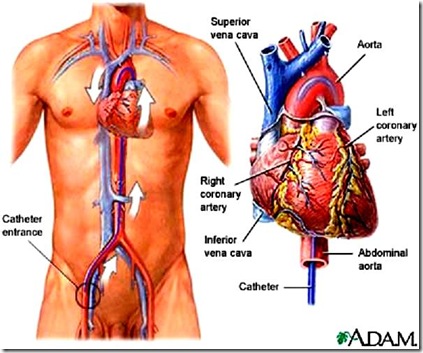 Heart Cath Procedure Heart Cath Procedure
