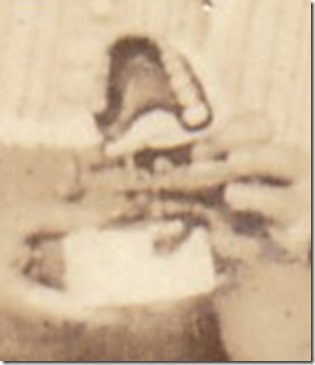 Fred Webster Teeth Model Close-up in 1926 Louisiana Fred Webster Teeth Model Close-up in 1926 Louisiana