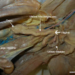 ovary_L.JPG