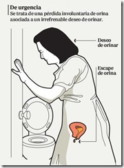incontinencia urinaria de urgencia