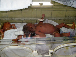 Des nouveu-nés dans une couveuse à l'hôpital général de Kinshasa, janvier 2011.