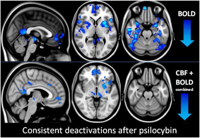 [79413680-Neural-Correlates-of-the-Psychedelic-State-as-Determined-by-fMRI-Studies-With-Psilocybin%255B13%255D.jpg]