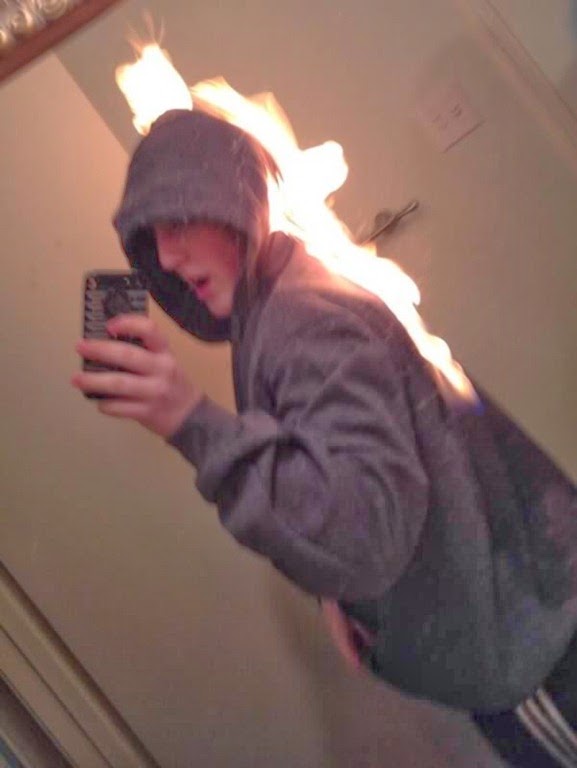 [a98889_extreme-selfie_6-burning3.jpg]