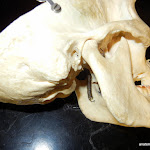 skull_mastoid_unlabeled.JPG